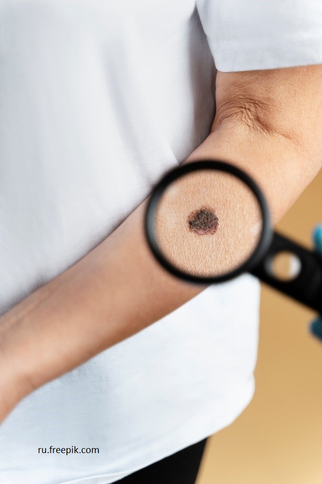 Новая служба помогает гериатрическим пациентам с кожными патологиями